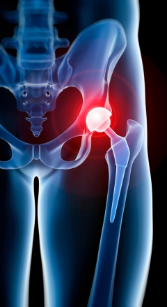 Orthopedic surgical treatments in Lullanagar, kondhwa, Pune