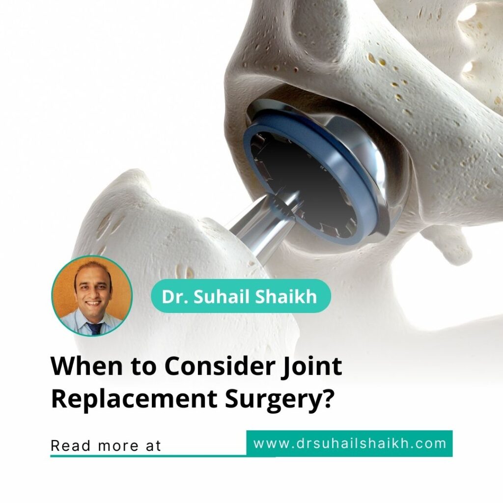 Joint replacement surgeon in Pune Dr. Suhail Shaikh